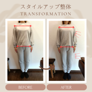 浦田さんビフォーアフター（正面）