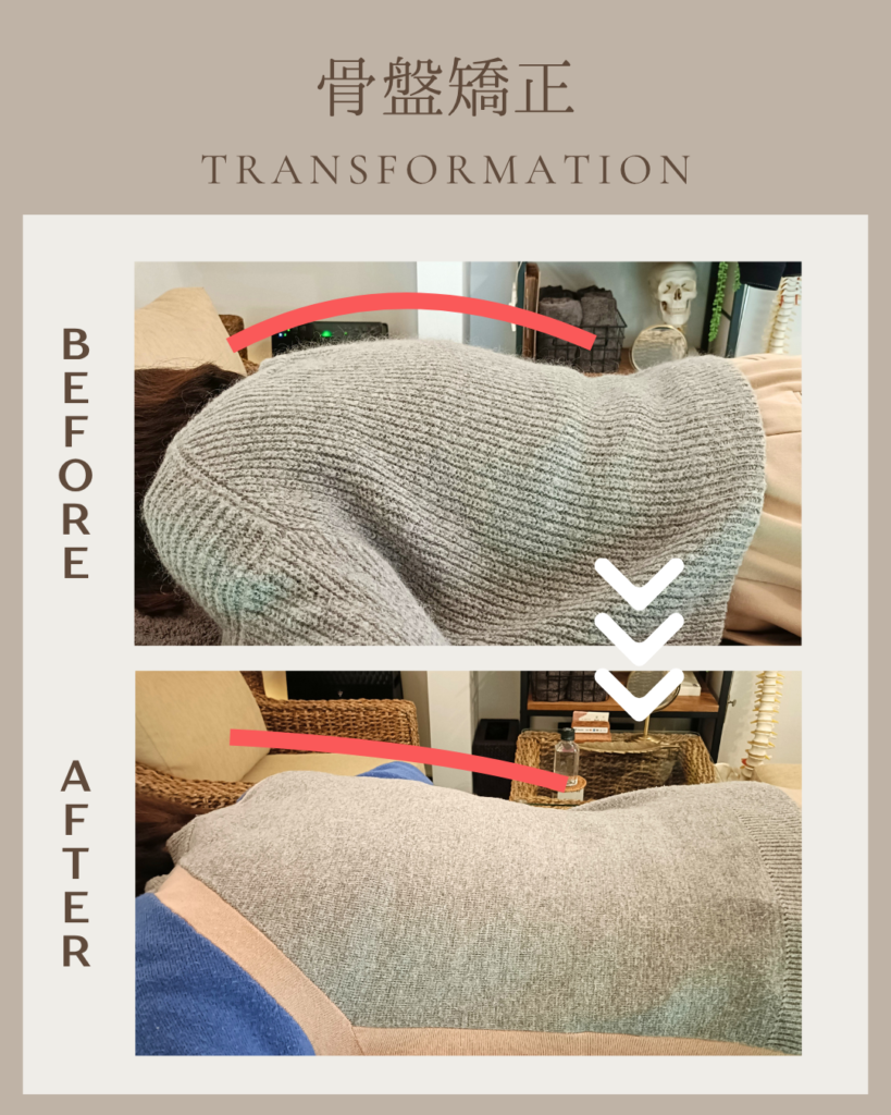 山口さんbefore after1