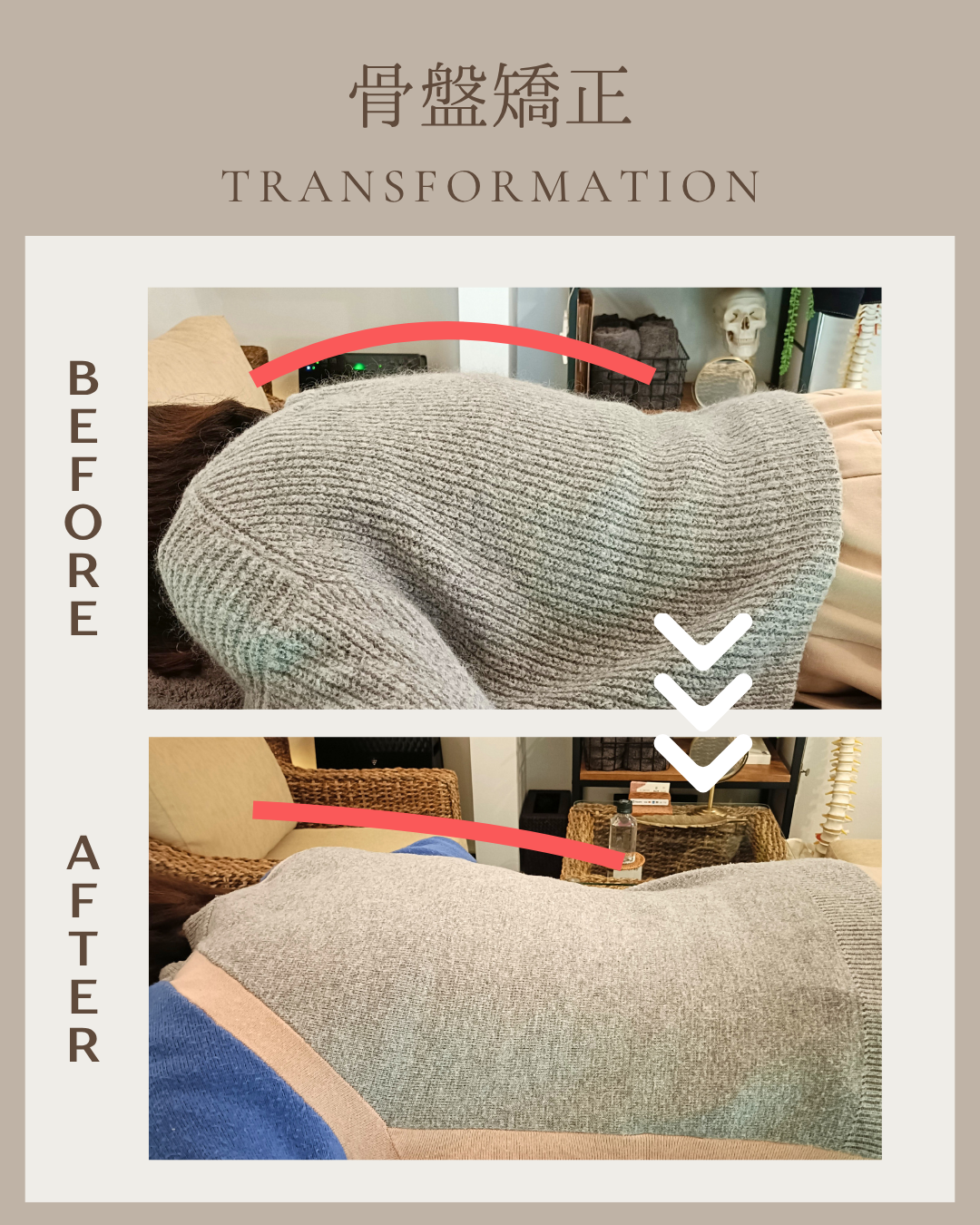 山口さんbefore after1